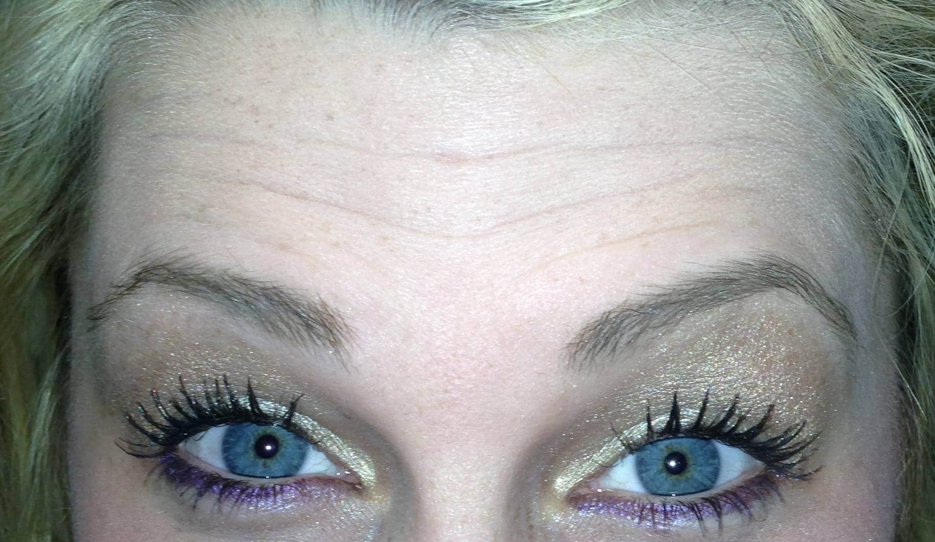 Botox Westborough MA | Worcester MA Botox Westborough MA | Worcester MA