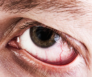 Cataract Treatment | Laser Cataract Surgery Westborough MA | Worcester MA Cataract Treatment | Laser Cataract Surgery Westborough MA | Worcester MA