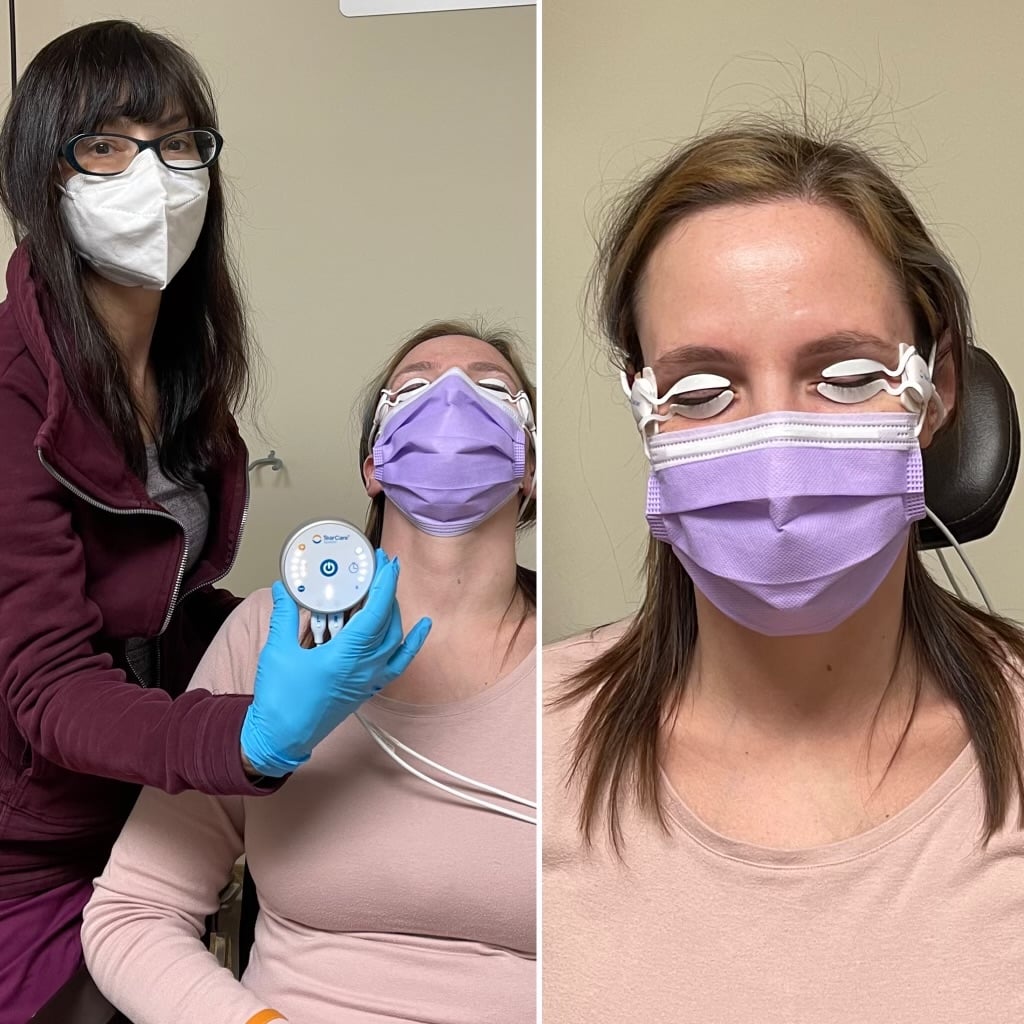 female patient with eyes closed undergoing dry eye treatment wearing tearcare device on each eye