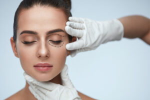 A doctor marking a patient’s eye for eyelid surgery
