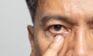 A close-up shot of a man pointing to his eye