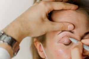Woman having her eye drawn on by her eye doctor during a consultation for eyelid surgery